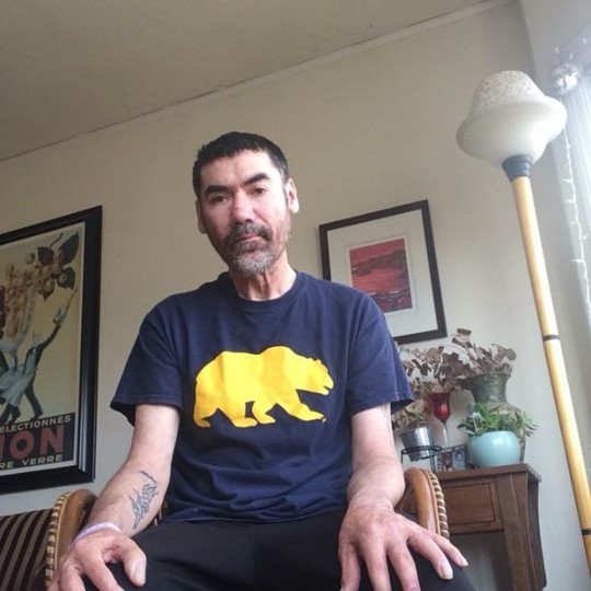 mike in oakland soon after diagnosis 2018